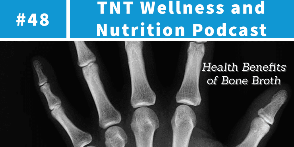 Read more about the article Podcast Episode 48 Health Benefits of Bone Broth