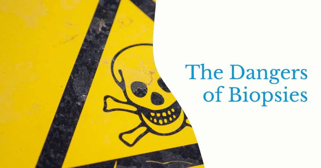 Read more about the article Podcast Episode 132 The Dangers of Biopsies