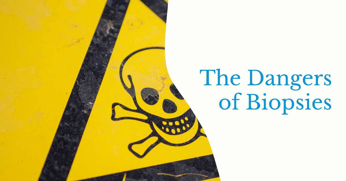You are currently viewing Podcast Episode 132 The Dangers of Biopsies