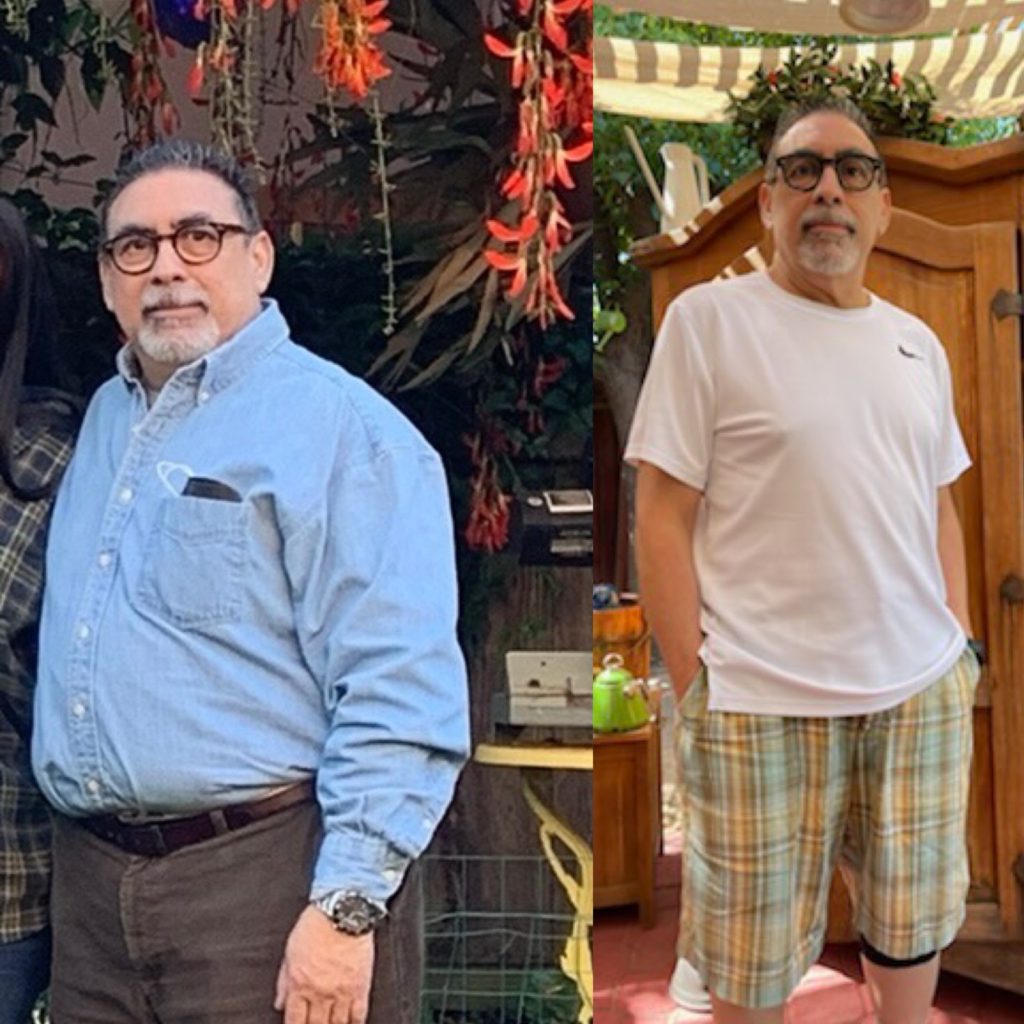 Before & After